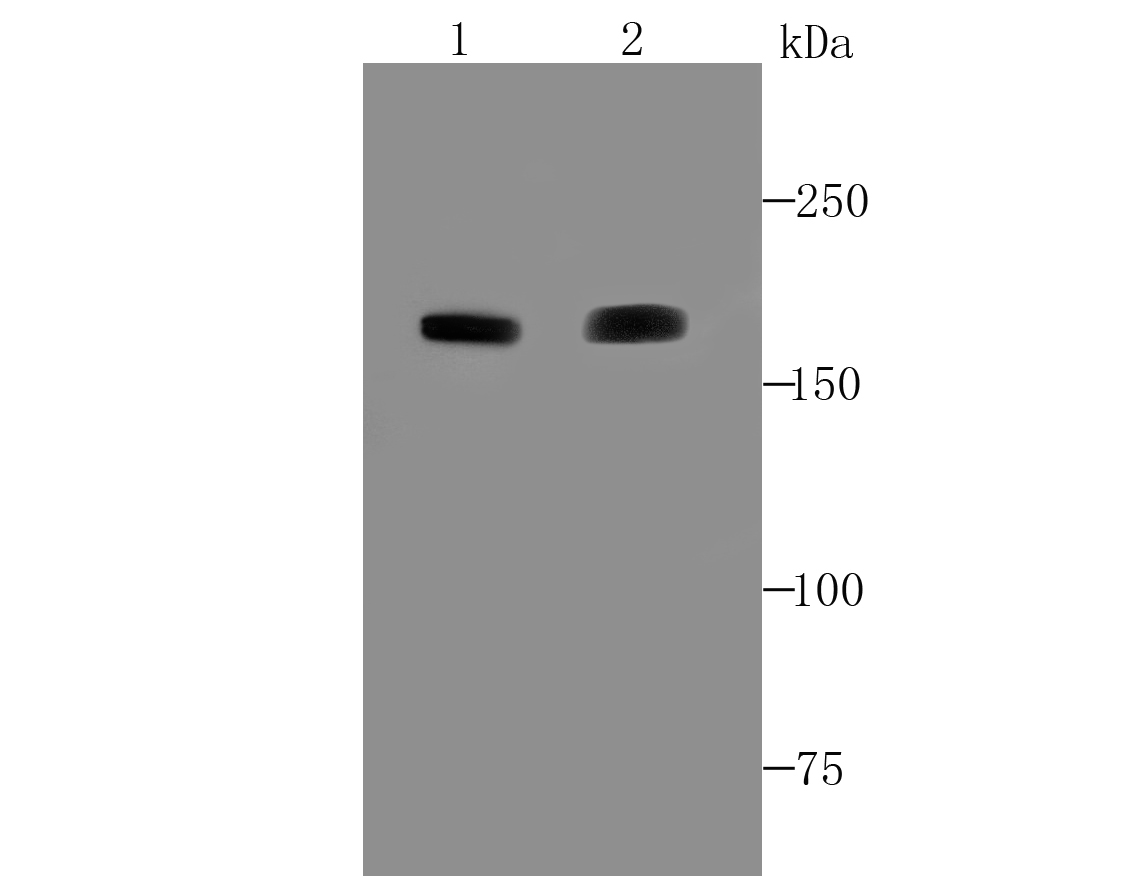ACE Antibody