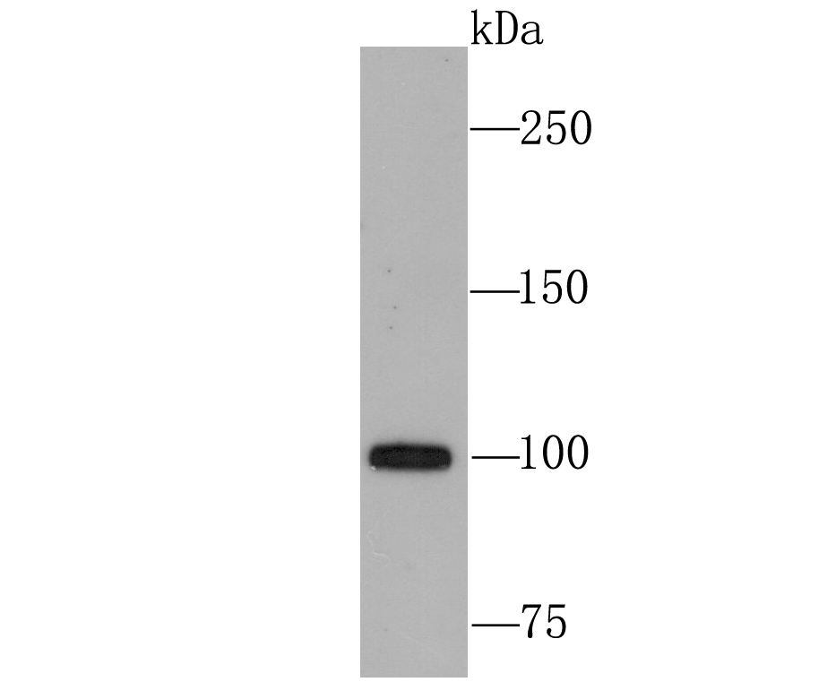 USP11 Antibody