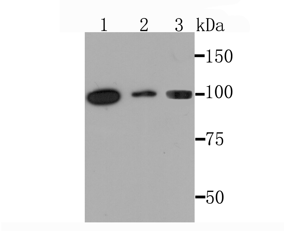 PKC mu Antibody