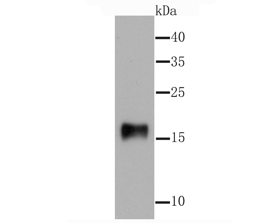 gamma Synuclein Antibody