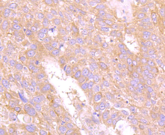 Carcino Embryonic Antigen CEA Antibody