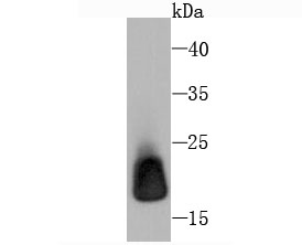 Ferritin Light Chain Antibody