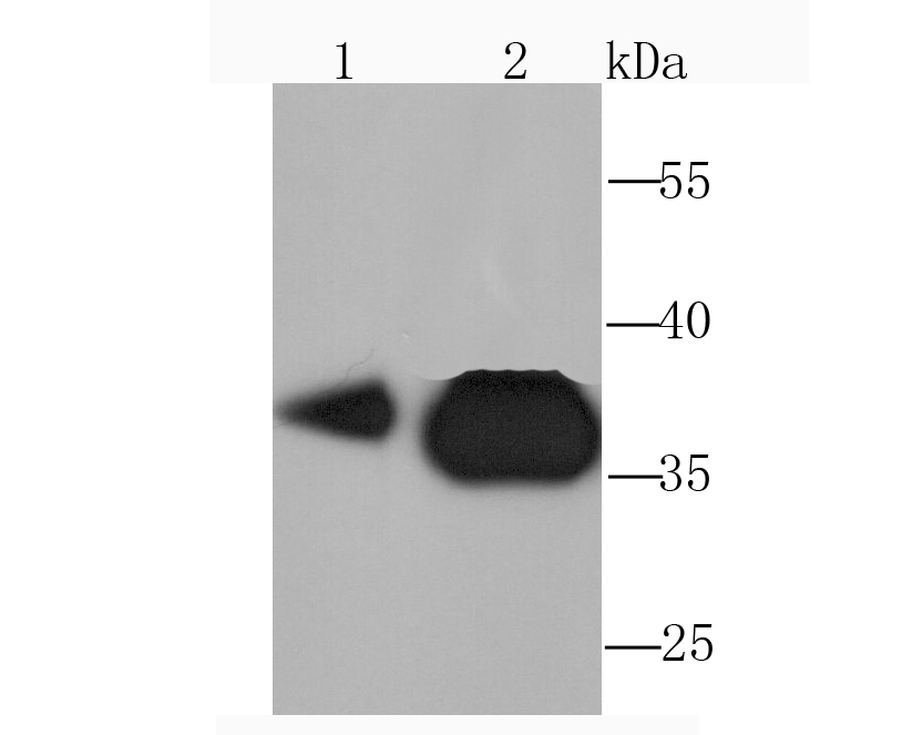 Pyruvate Dehydrogenase E1 beta subunit Antibody