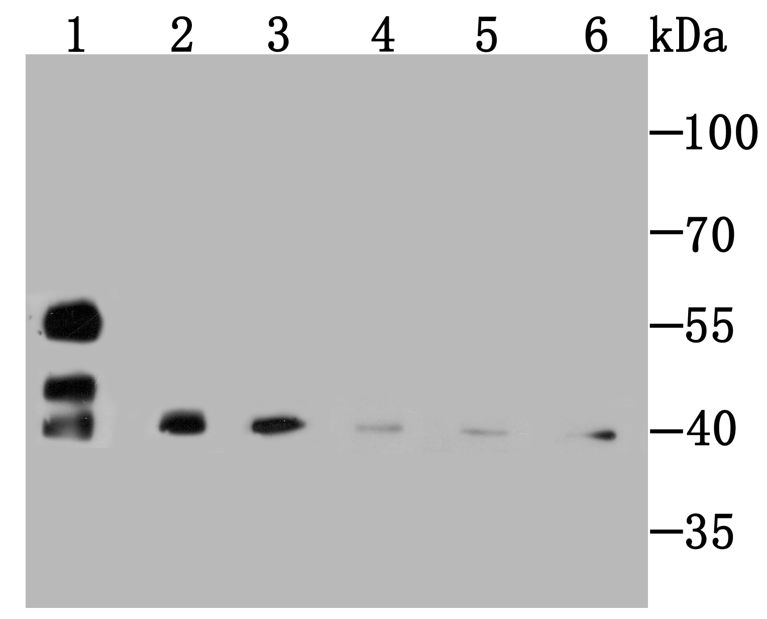 SMYD3 Antibody
