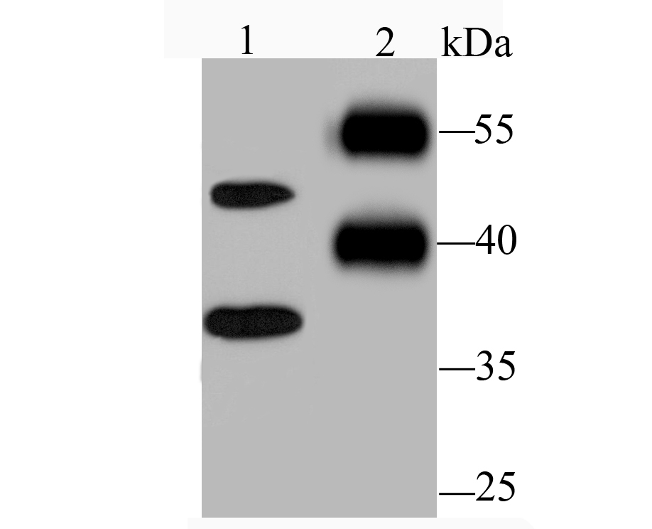 Nogo B Antibody