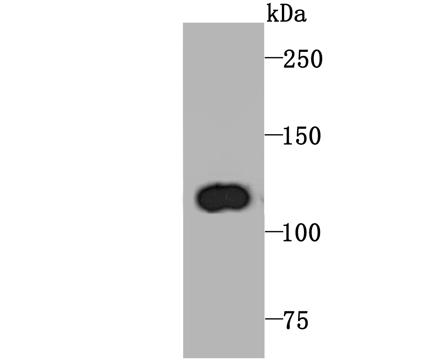 PGC1 beta Antibody