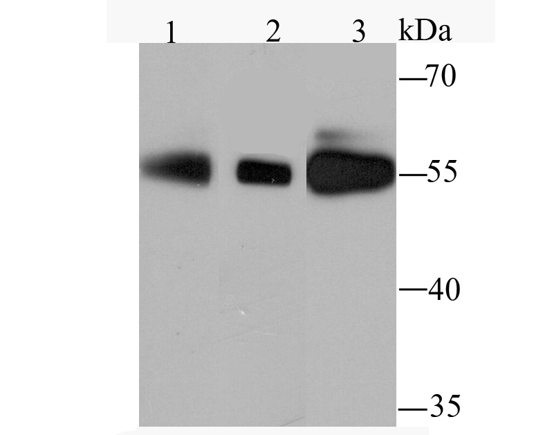 PFKFB3 Antibody