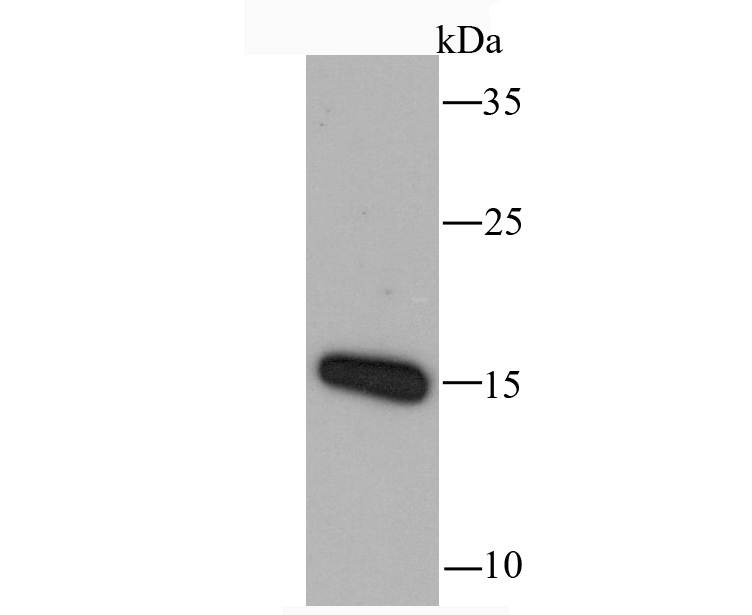 RANTES Antibody