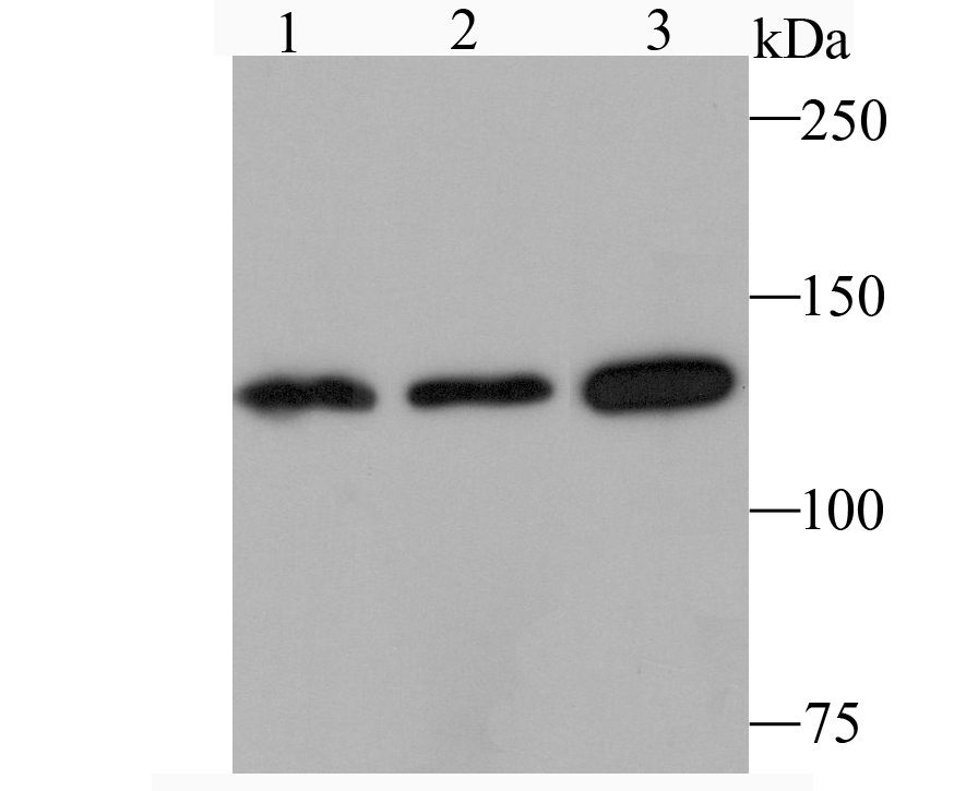 JAK1 Antibody