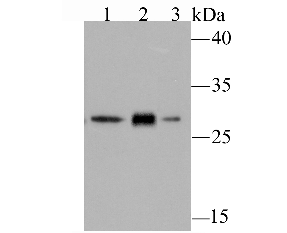 GCLM Antibody