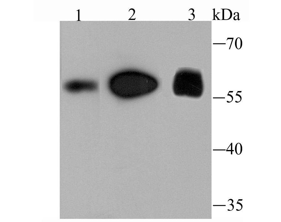 FTO Antibody