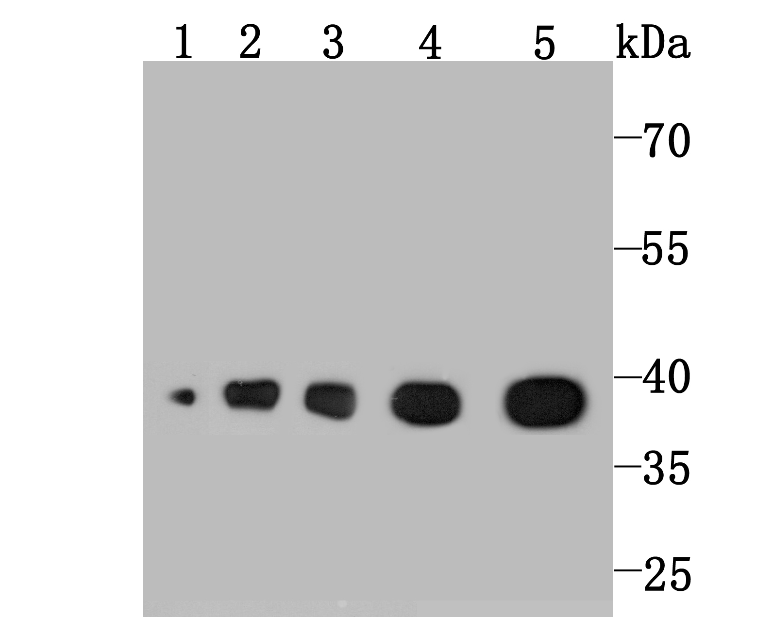 Aldolase Antibody