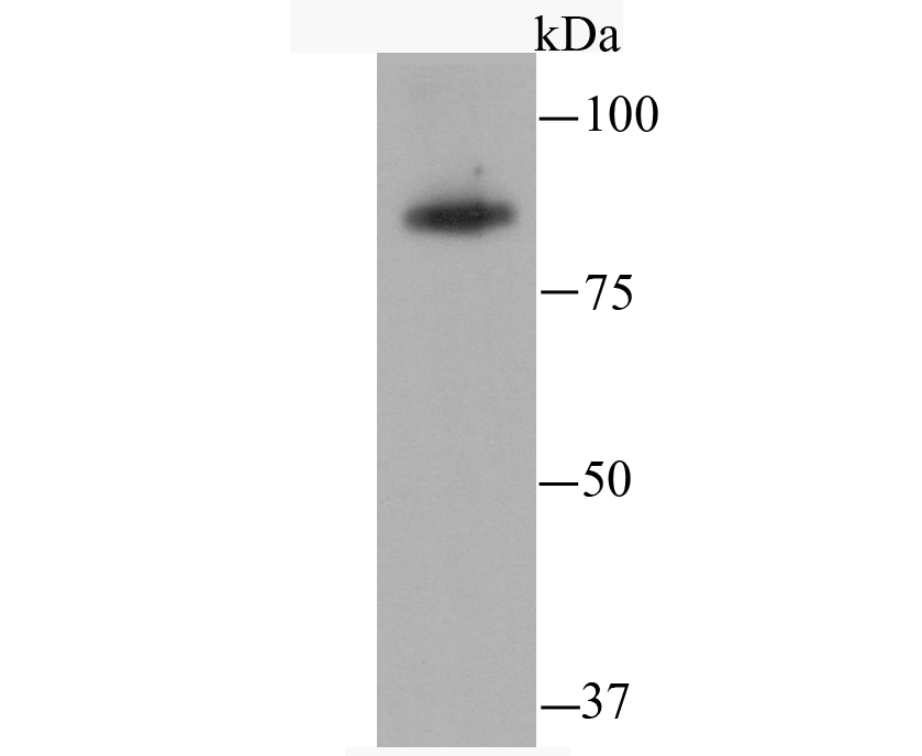 SATB2 Antibody