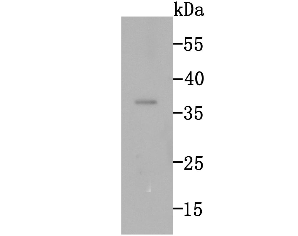 Rad51 Antibody