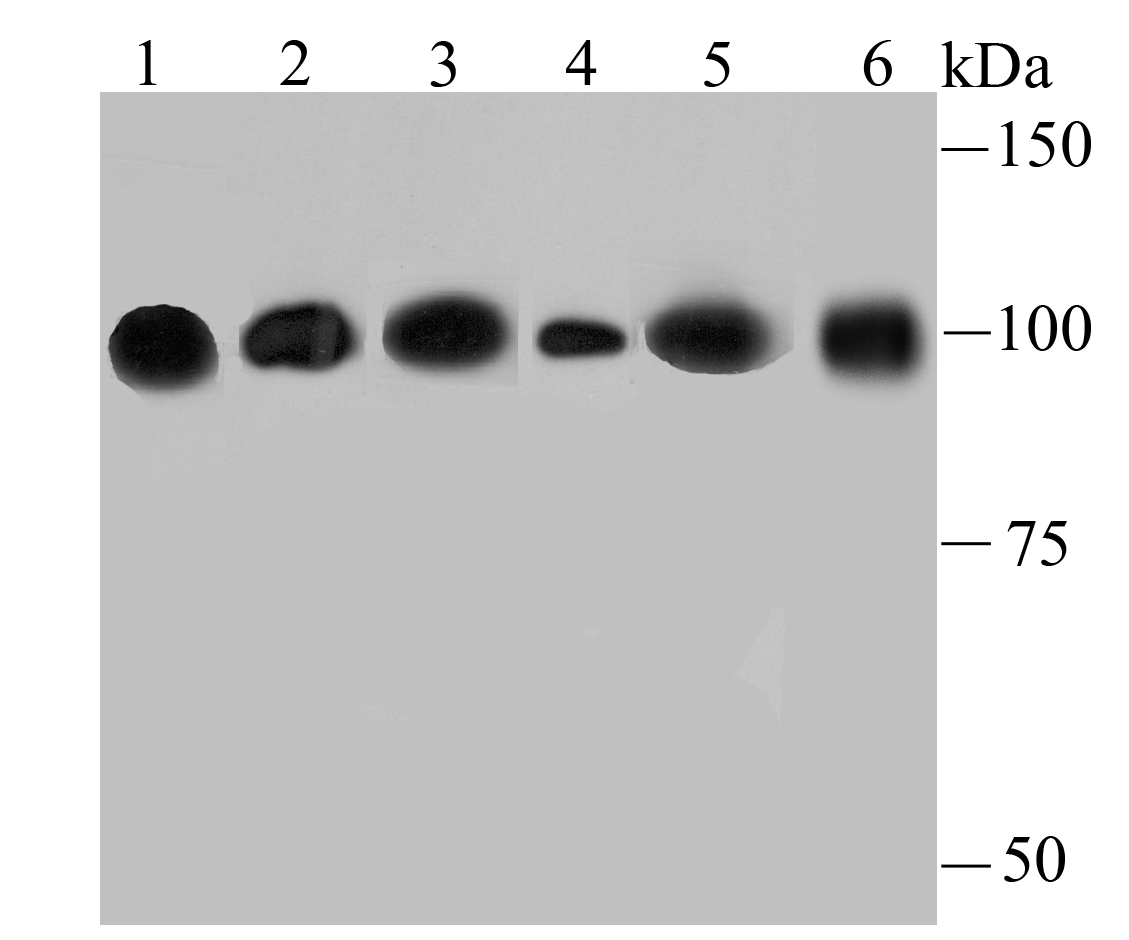 alpha Actinin 4 Antibody