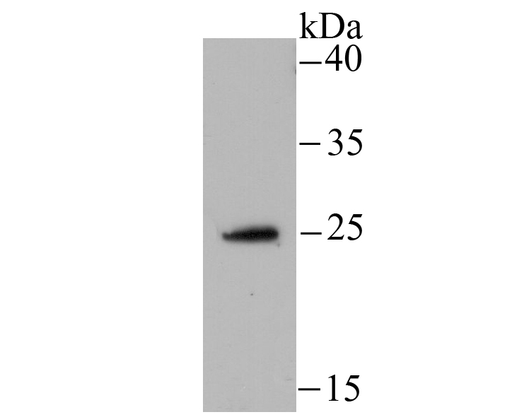 NDUFS3 Antibody