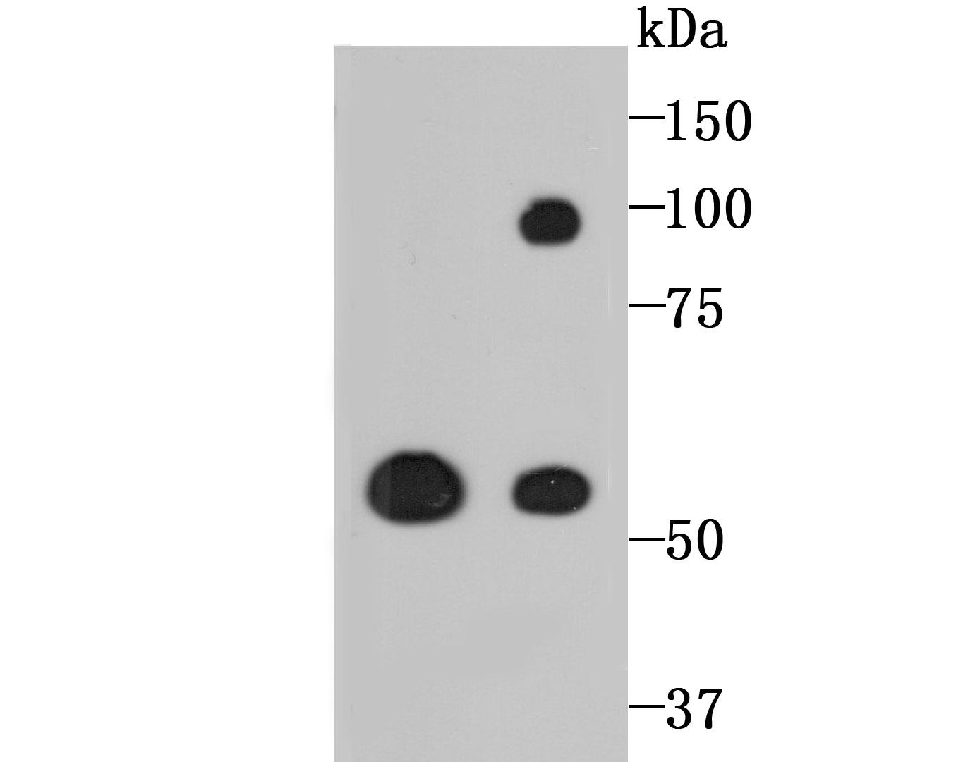 LOXL2 Antibody