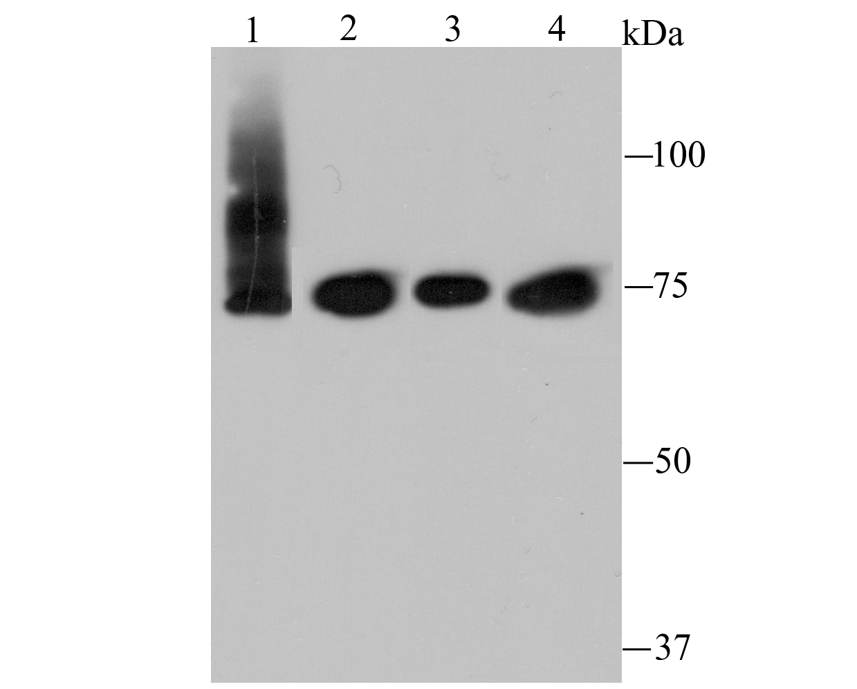 IKBKE Antibody