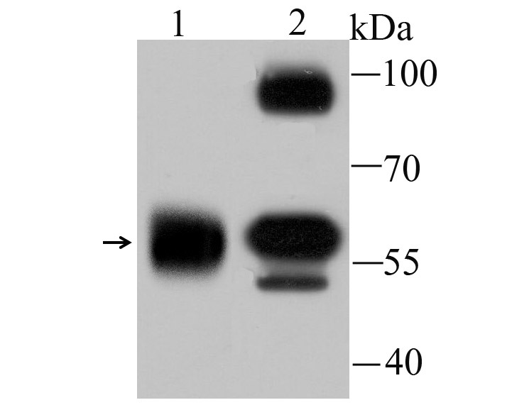 alpha Internexin Antibody