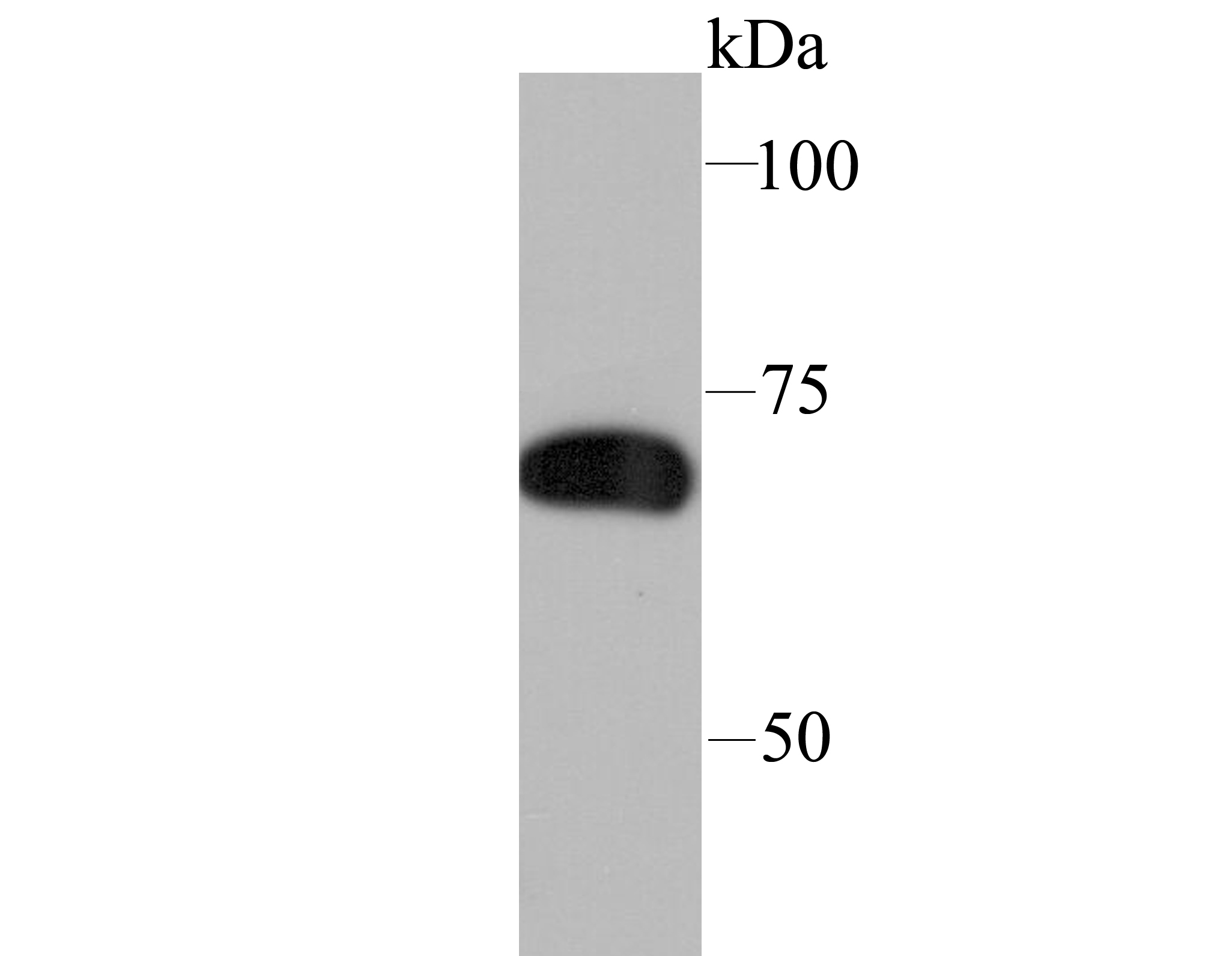 SAMHD1 Antibody