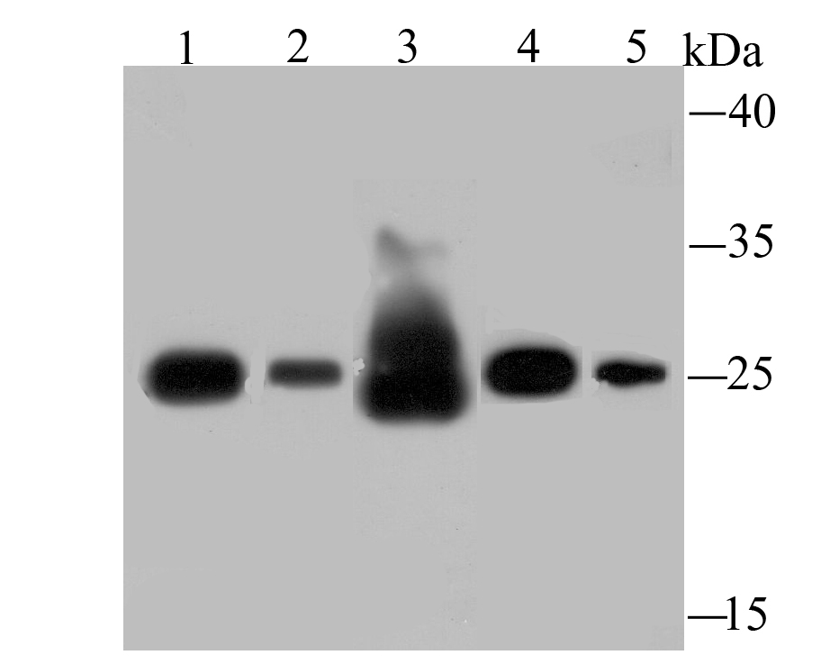 SDHB Antibody
