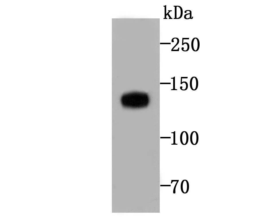 Involucrin Antibody
