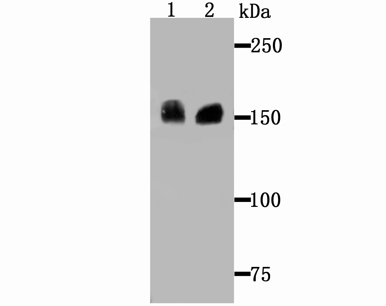 Drosha Antibody