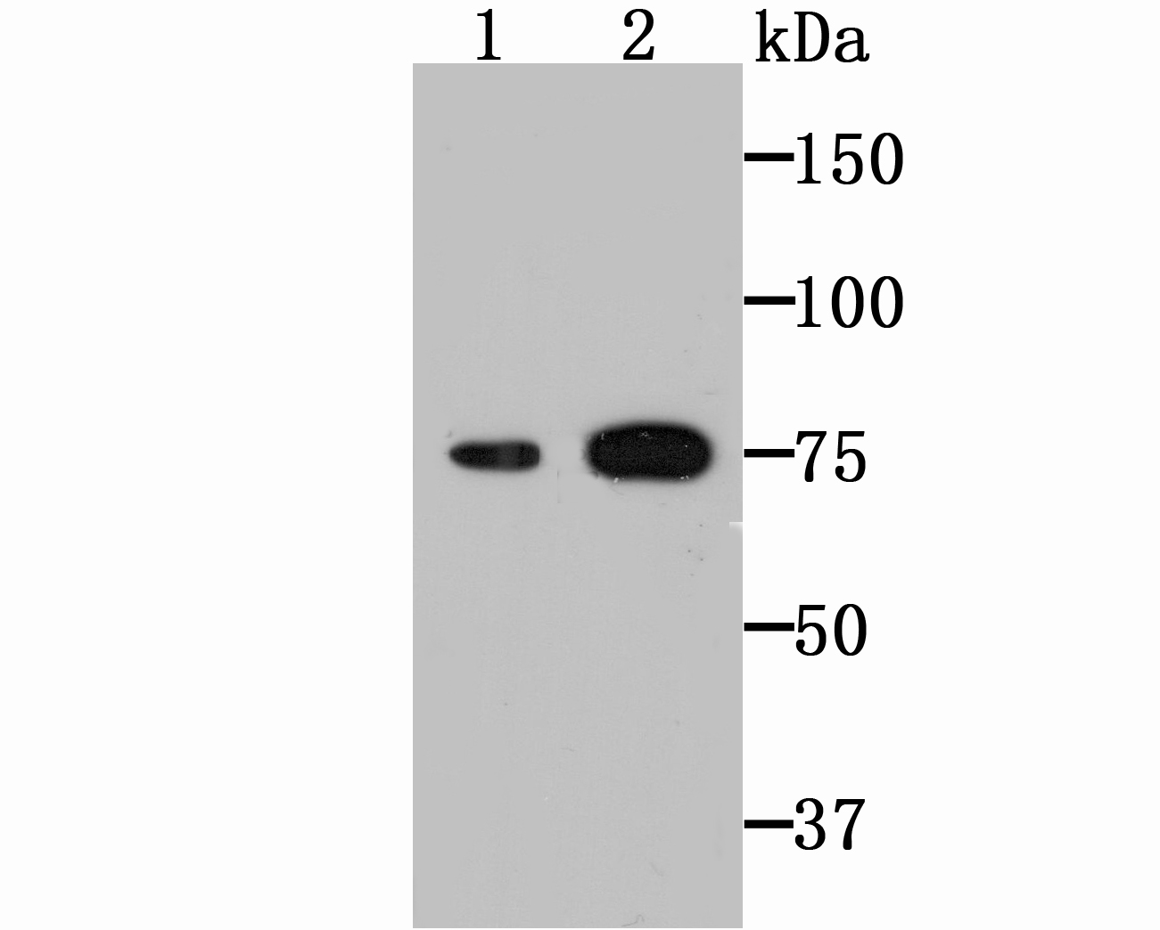 Transglutaminase 2 Antibody
