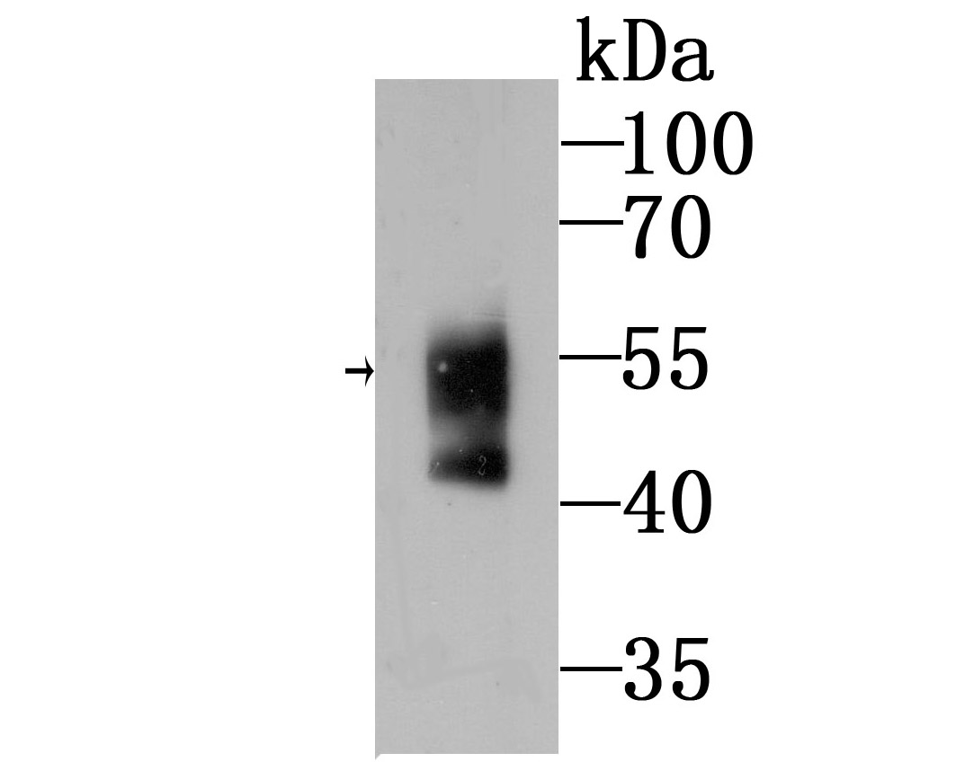 WASL Antibody