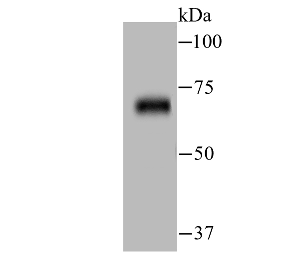 ZAP70 Antibody