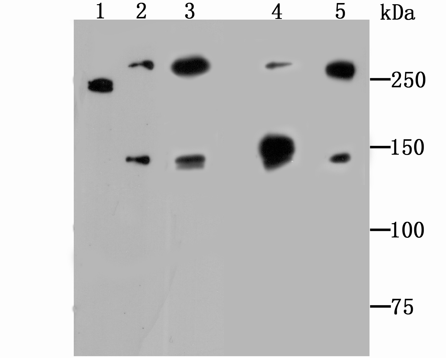 Alpha Fodrin Antibody