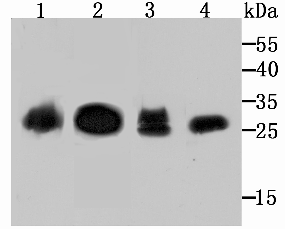 Carbonic anhydrase 2 Antibody