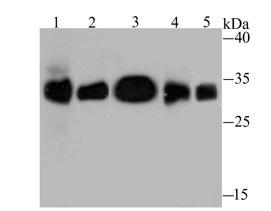 HLA-DQA1 Antibody