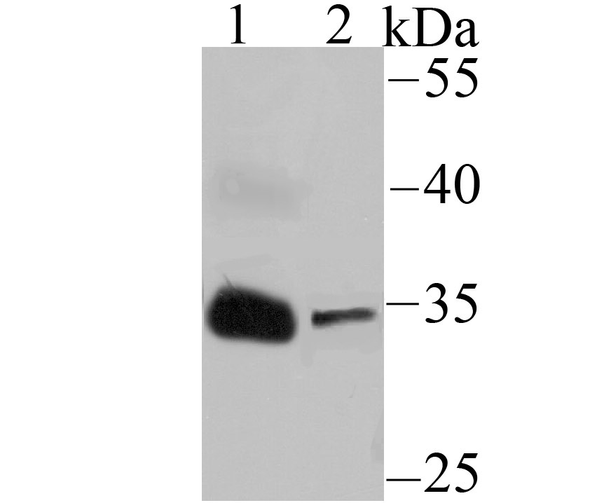 IGFBP2 Antibody
