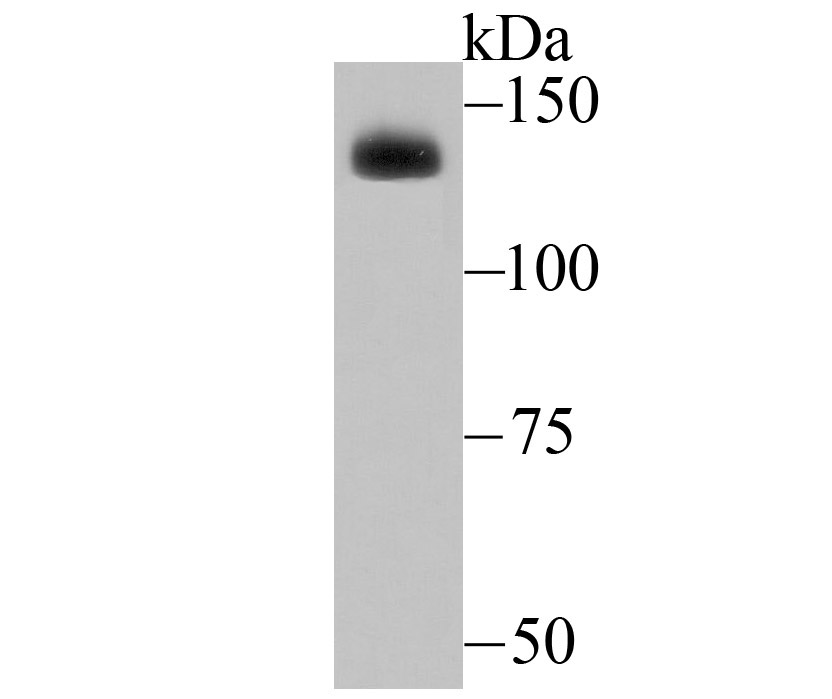 ADAR Antibody