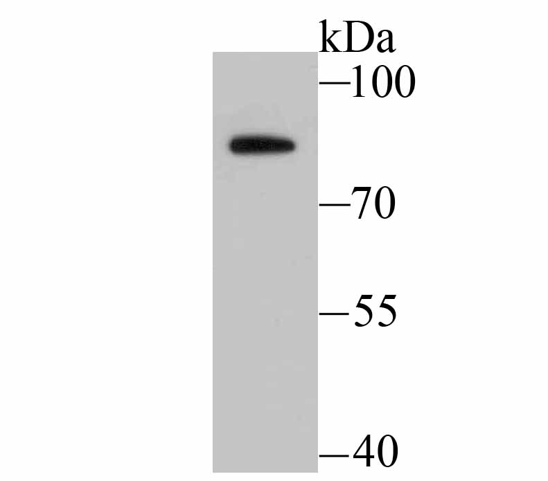 BDKRB2 Antibody