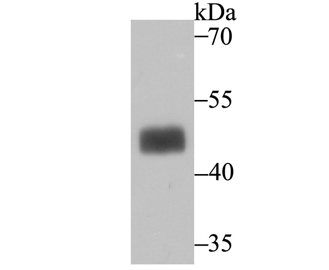 MAPKAP Kinase 2 Antibody