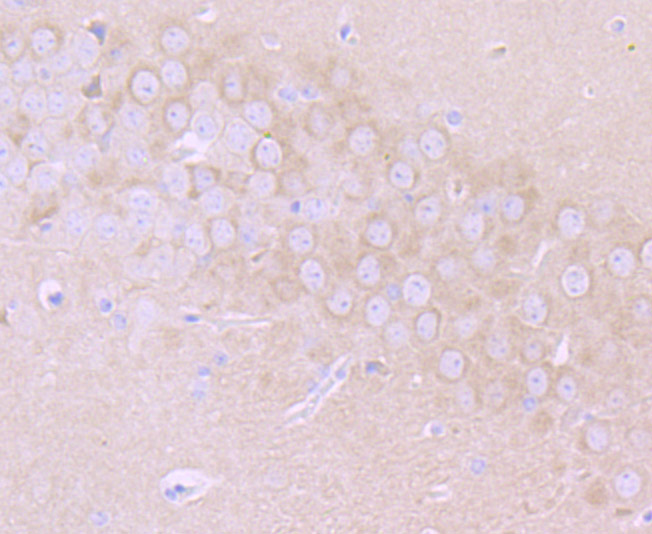 MMP17 Antibody