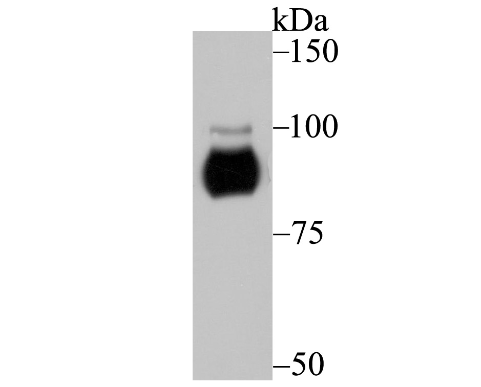 Protein Kinase D2 Antibody