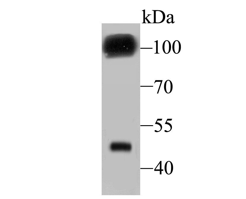 GABA B Receptor 2 Antibody