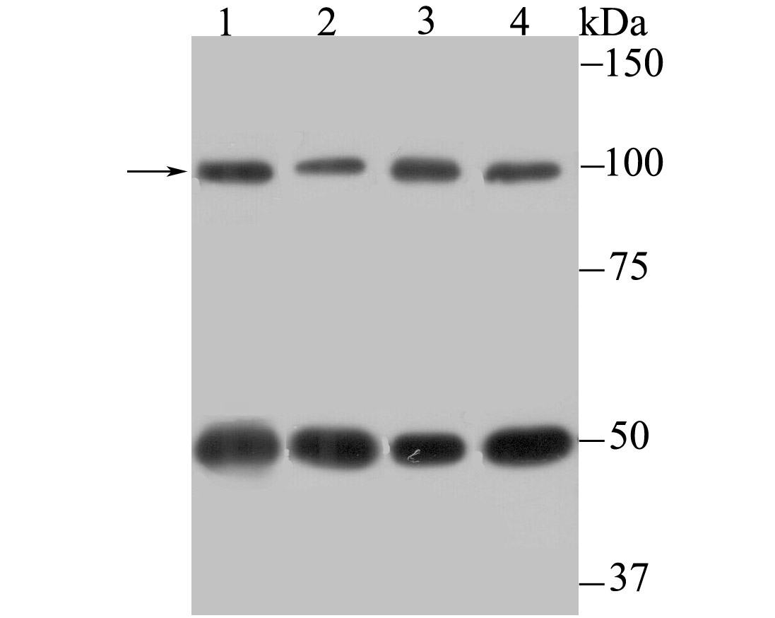 Cellular Apoptosis Susceptibility Antibody
