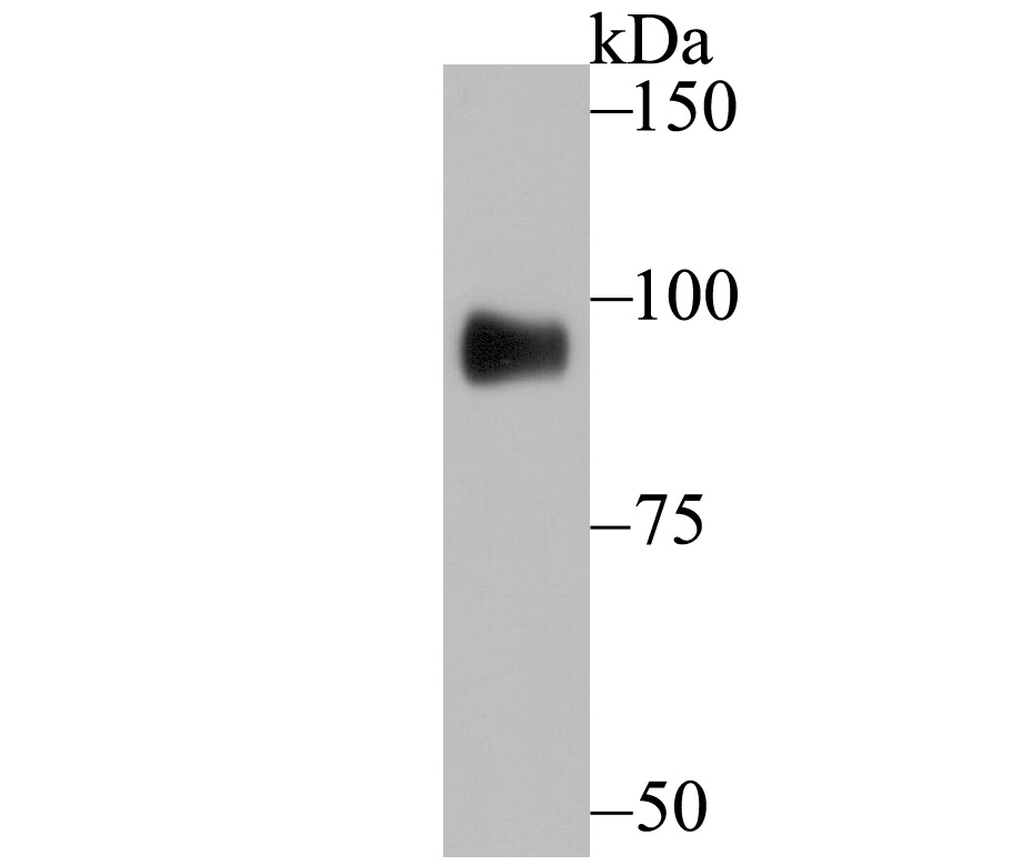 GIT1 Antibody