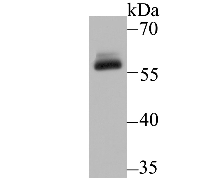 DKC1 Antibody