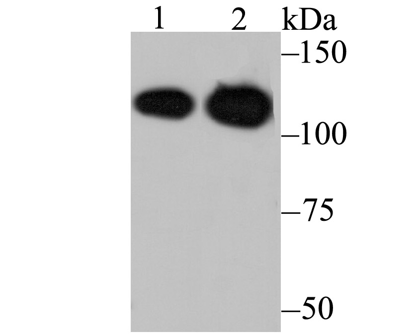 Matrin 3 Antibody