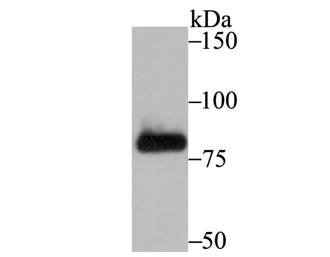 Fructose 6 Phosphate Kinase Antibody