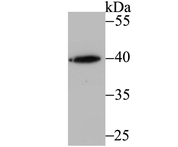 RING2 Antibody