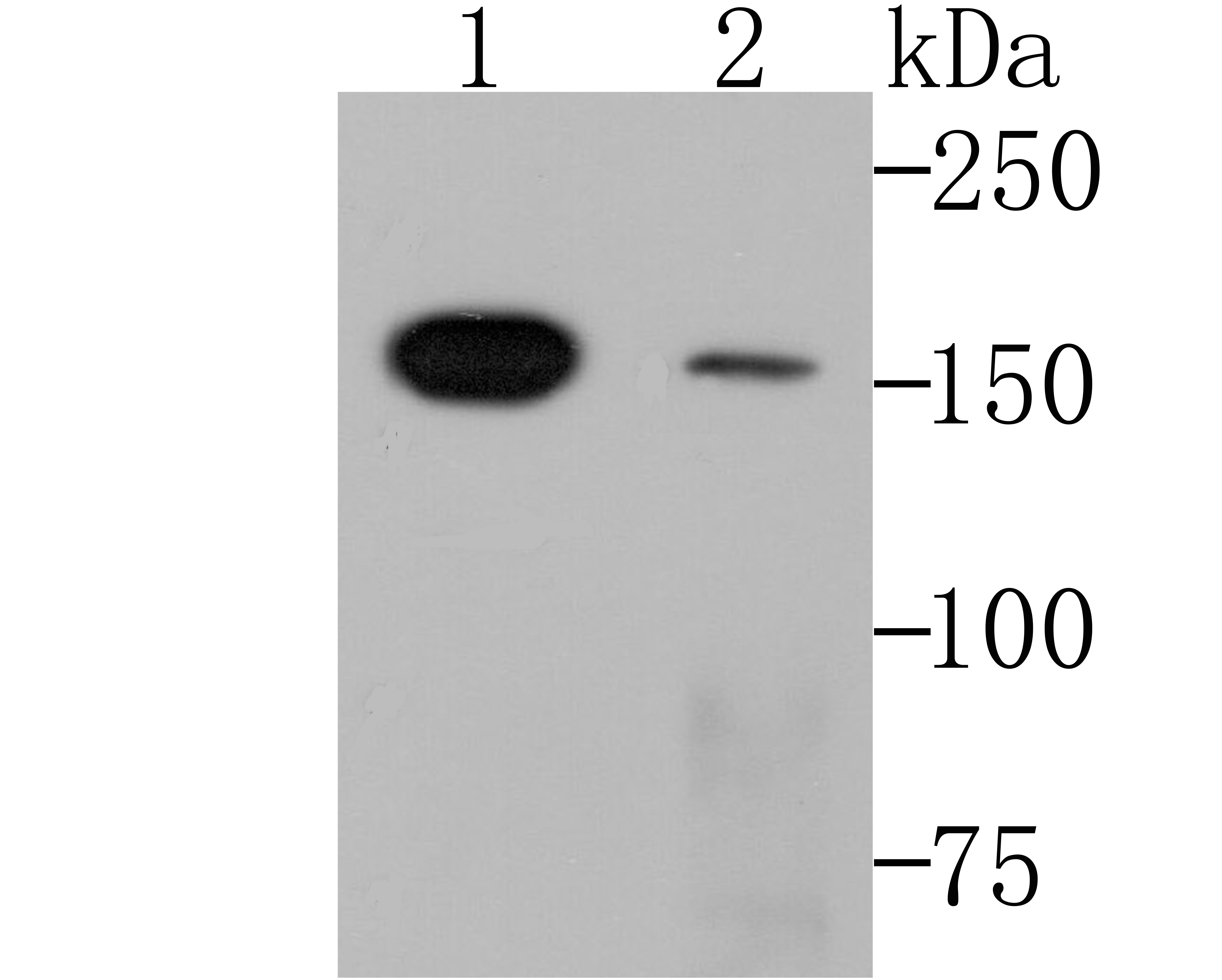 SMARCC1 Antibody