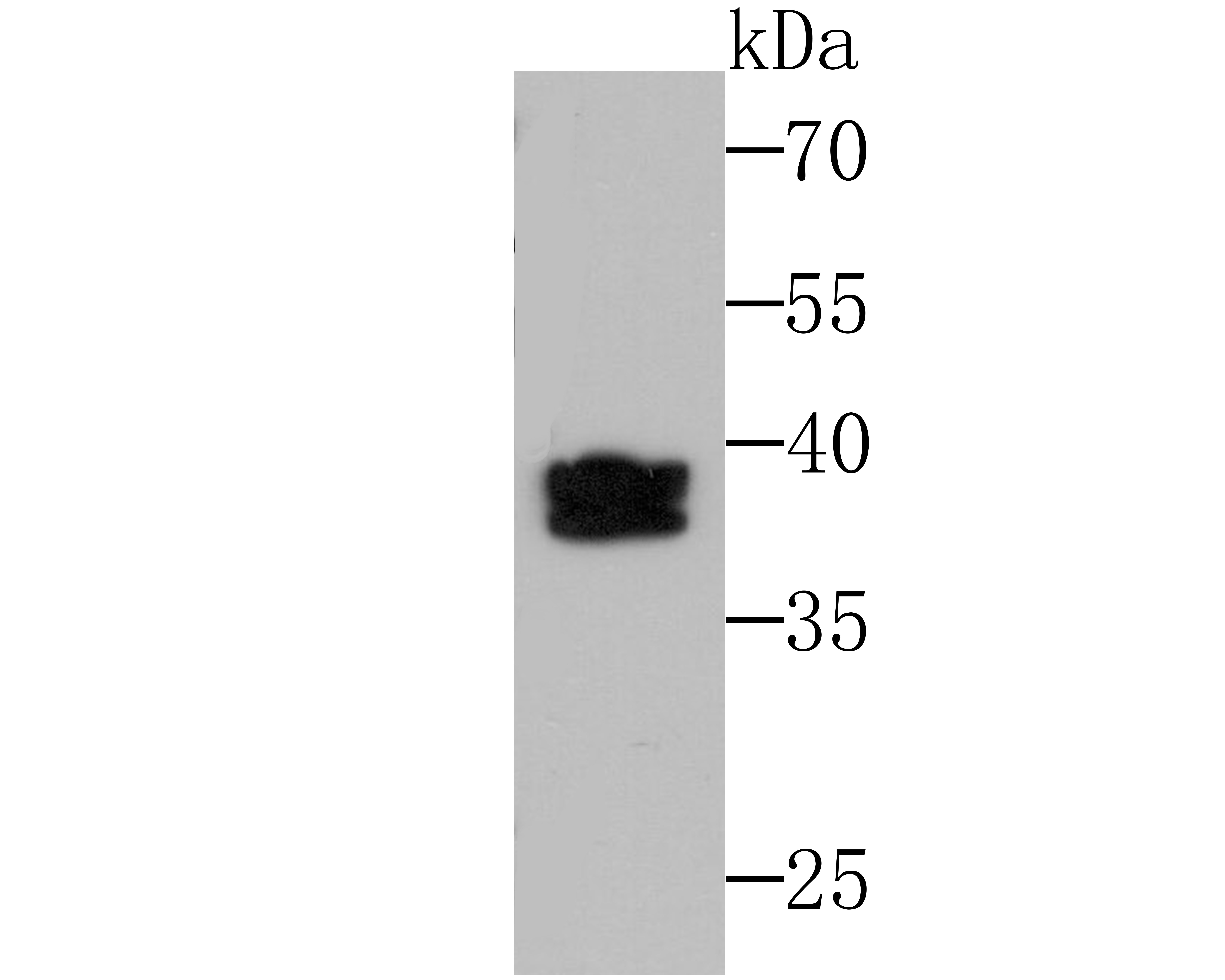 SET Antibody