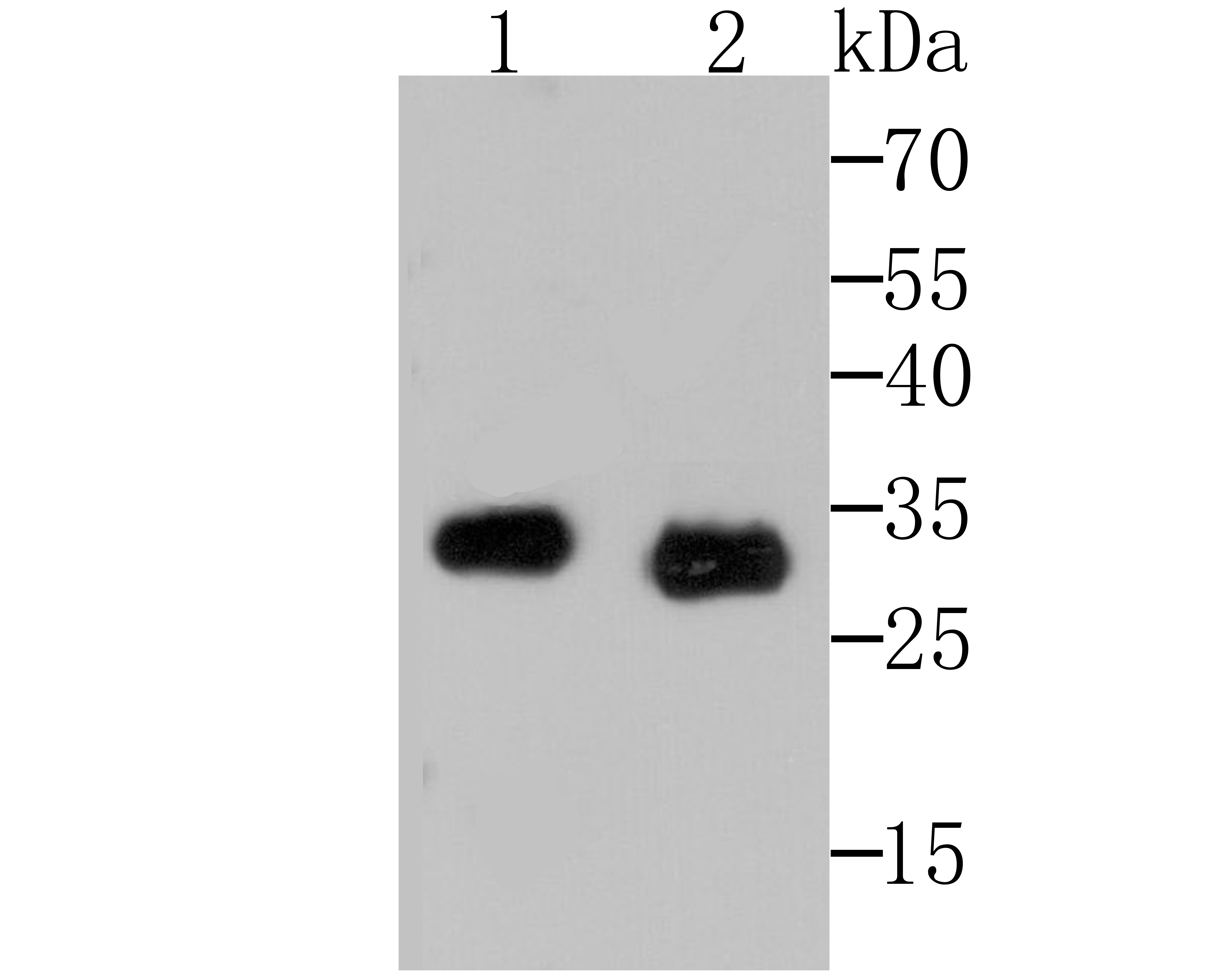 Mast Cell Chymase Antibody