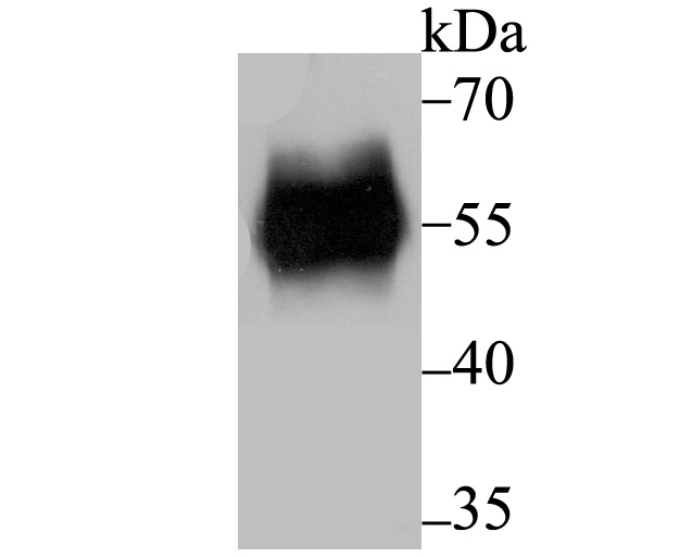 RBPJK Antibody